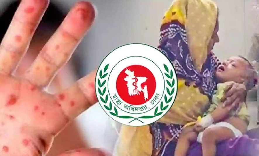 3 More Children Die with Measles Symptoms